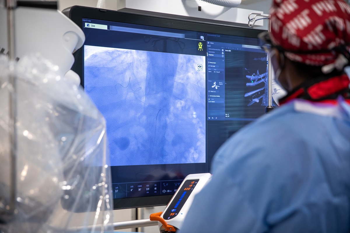 ‘The future of cancer therapy’ An innovative treatment performed at St. Michael’s Hospital for